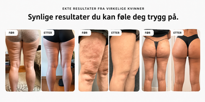 Formeleva - 3D Anti-Cellulite Leggings